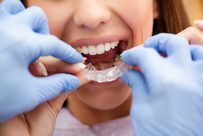 orthodontie avant garde