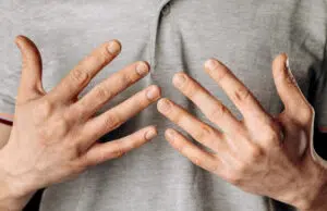 Comment savoir si son doigt est cassé en appuyant dessus ? savoir doigt cassé